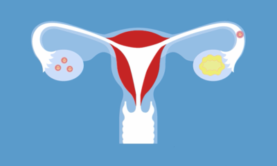 ciclo menstrual