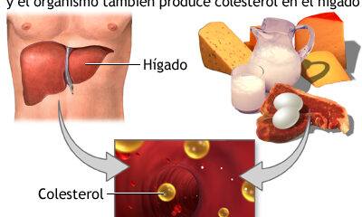 colesterol ldl