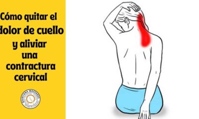 contractura cervical