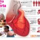 enfermedades cardiovasculares