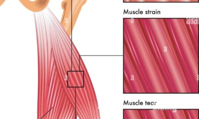 fibras musculares