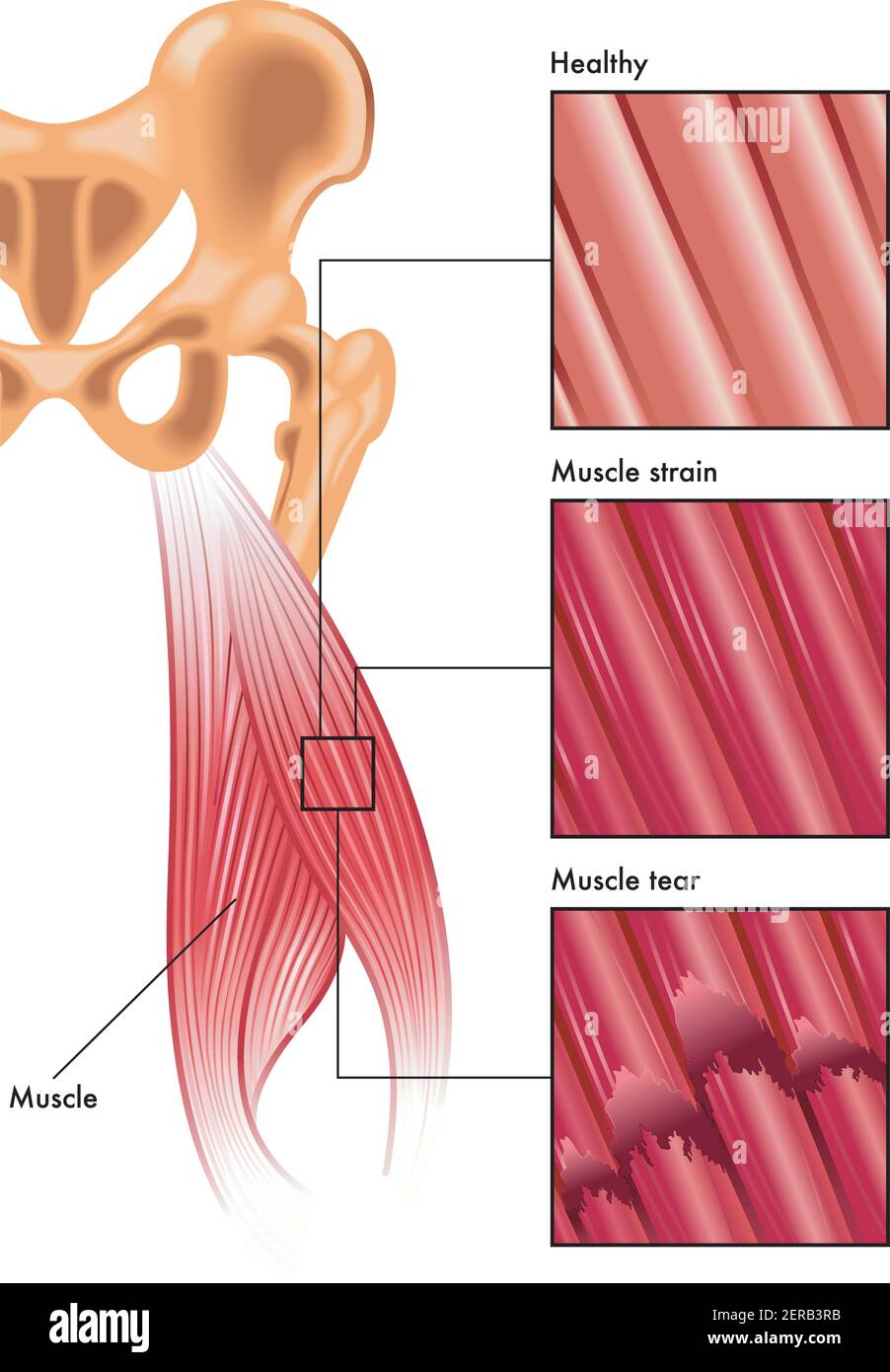 fibras musculares