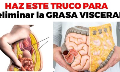 grasa visceral