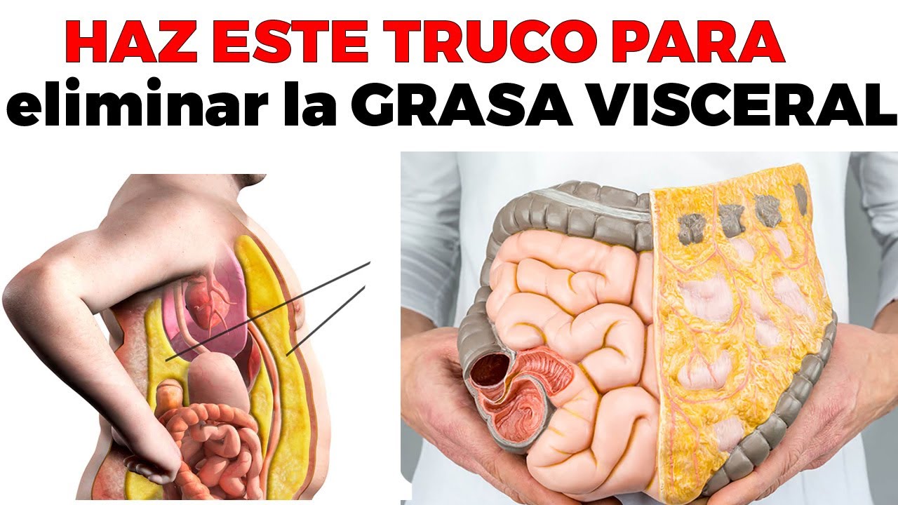 grasa visceral