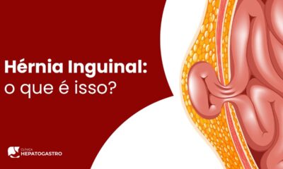 hernia inguinal