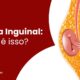 hernia inguinal