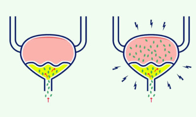 infeccion orina