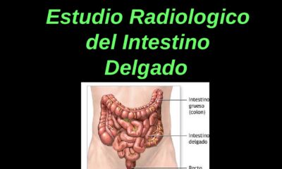 intestino delgado