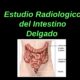 intestino delgado