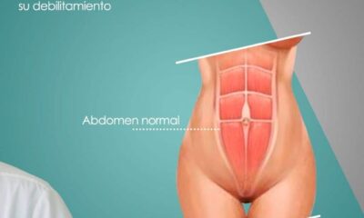 musculos abdominales