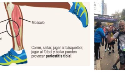 periostitis tibial