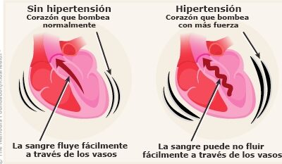 presion arterial