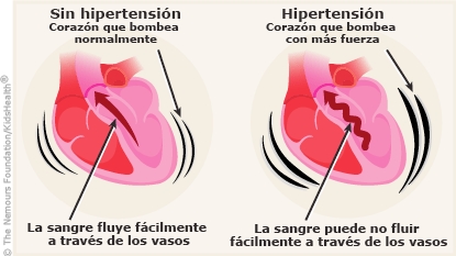 presion arterial