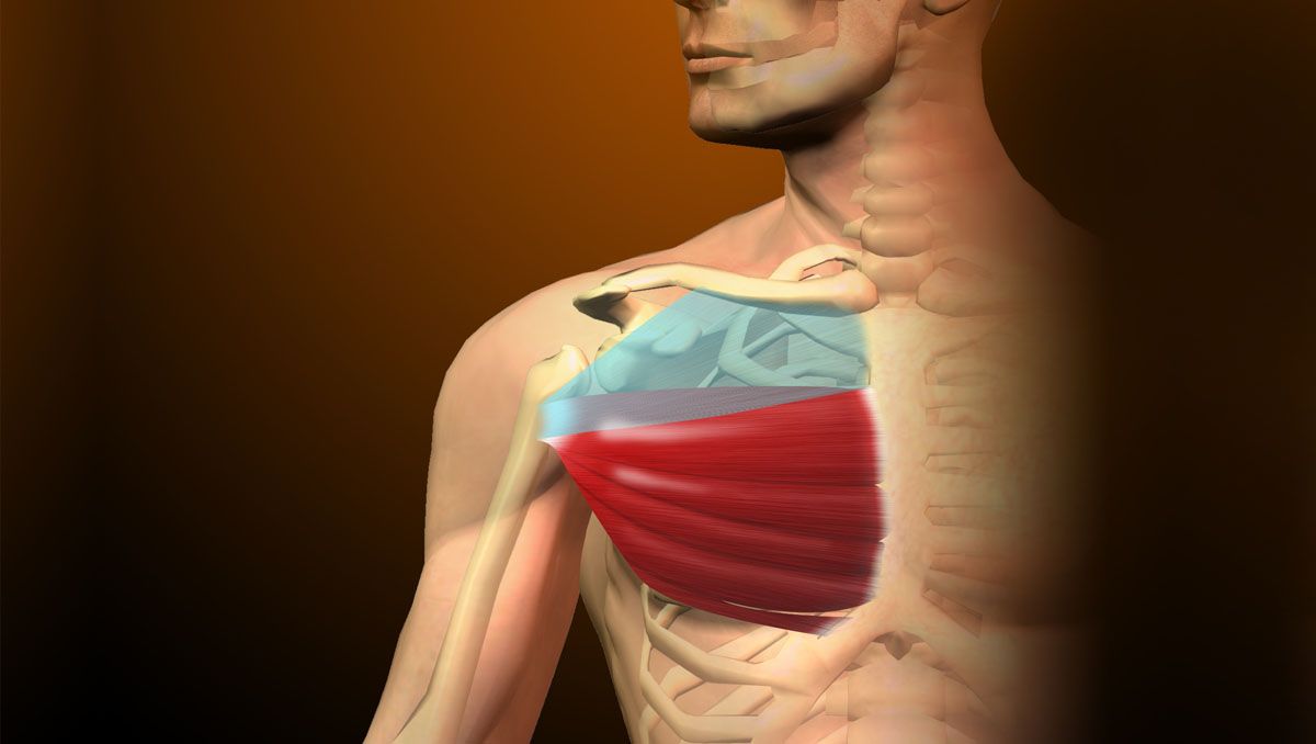 tendinitis pectoral