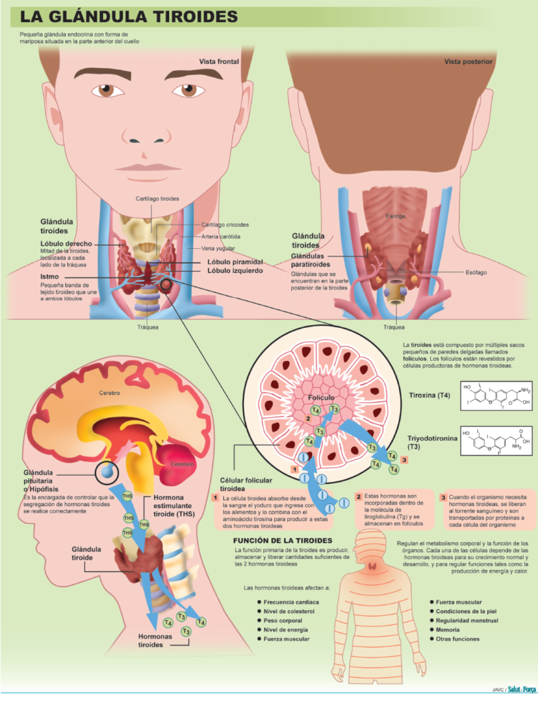 tiroiditis hashimoto