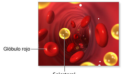 colesterol ldl