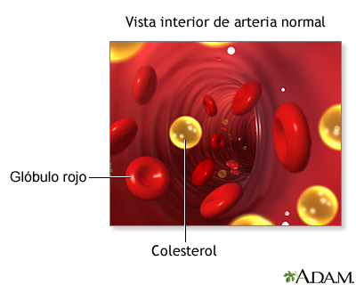 colesterol ldl