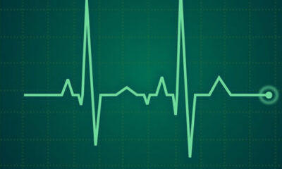 frecuencia cardiaca
